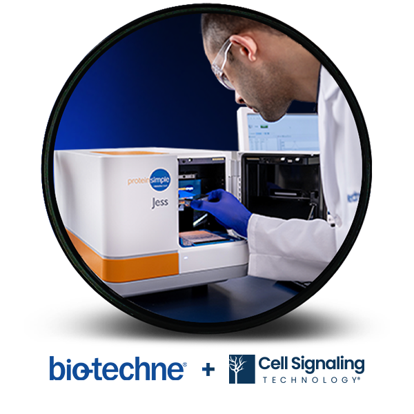 Bringing The Western Blot Into The 21st Century With Automated Simple Western A Customers 6927