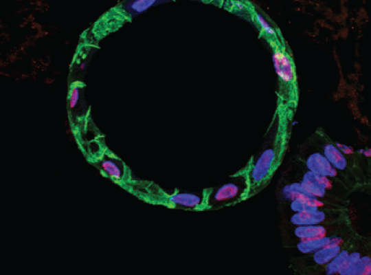 Human Gastric Organoids