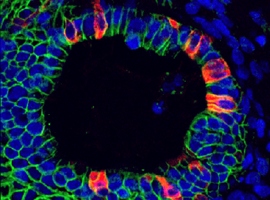 Human Intestinal Organoids