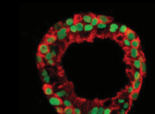 Human Lung Organoids